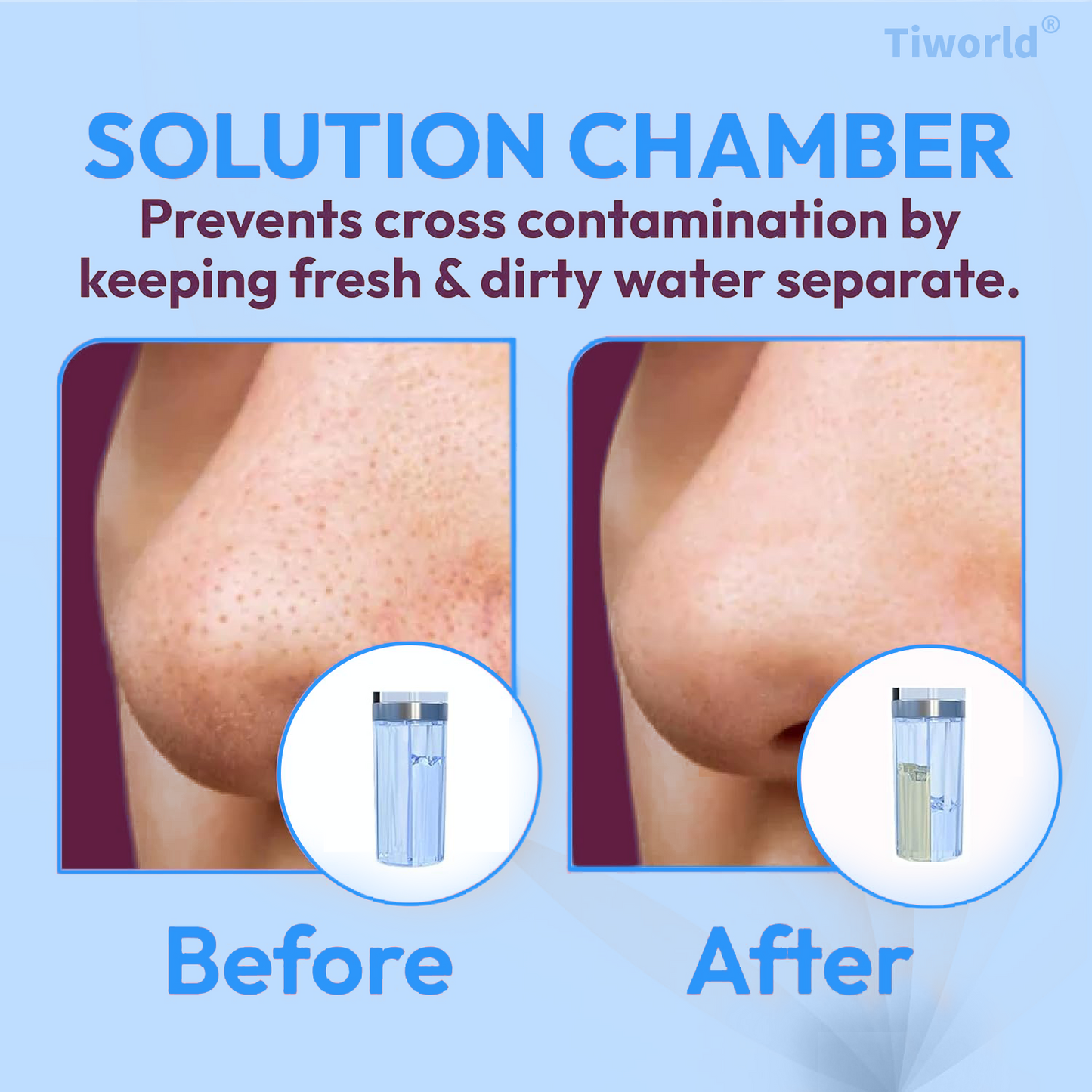 𝐓𝐢𝐰𝐨𝐫𝐥𝐝® 𝐏𝐫𝐨𝐟𝐞𝐬𝐬𝐢𝐨𝐧𝐚𝐥 𝐁𝐥𝐚𝐜𝐤𝐡𝐞𝐚𝐝 𝐑𝐞𝐦𝐨𝐯𝐞𝐫 𝐏𝐨𝐫𝐞 𝐕𝐚𝐜𝐮𝐮𝐦 – 𝐀𝐪𝐮𝐚 𝐏𝐫𝐨 𝐇𝐲𝐝𝐫𝐨𝐝𝐞𝐫𝐦𝐚𝐛𝐫𝐚𝐬𝐢𝐨𝐧 𝐓𝐨𝐨𝐥