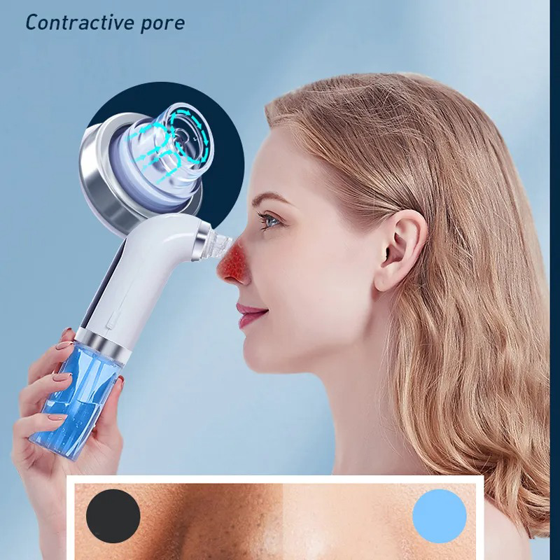 𝐓𝐢𝐰𝐨𝐫𝐥𝐝® 𝐏𝐫𝐨𝐟𝐞𝐬𝐬𝐢𝐨𝐧𝐚𝐥 𝐁𝐥𝐚𝐜𝐤𝐡𝐞𝐚𝐝 𝐑𝐞𝐦𝐨𝐯𝐞𝐫 𝐏𝐨𝐫𝐞 𝐕𝐚𝐜𝐮𝐮𝐦 – 𝐀𝐪𝐮𝐚 𝐏𝐫𝐨 𝐇𝐲𝐝𝐫𝐨𝐝𝐞𝐫𝐦𝐚𝐛𝐫𝐚𝐬𝐢𝐨𝐧 𝐓𝐨𝐨𝐥